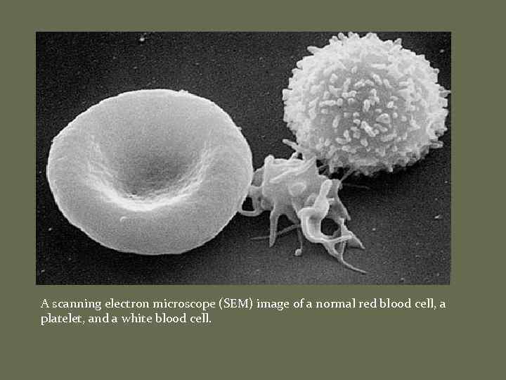 A scanning electron microscope (SEM) image of a normal red blood cell, a platelet,