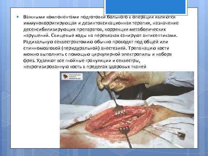  Важными компонентами подготовки больного к операции являются иммунокорригирующая и дезинтоксикационная терапия, назначение десенсибилизирующих