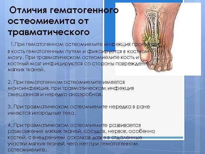 Отличия гематогенного остеомиелита от травматического 1. При гематогенном остеомиелите инфекция проникает в кость гематогенным