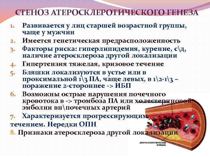 СТЕНОЗ АТЕРОСКЛЕРОТИЧЕСКОГО ГЕНЕЗА Развивается у лиц старшей возрастной группы, чаще у мужчин 2. Имеется