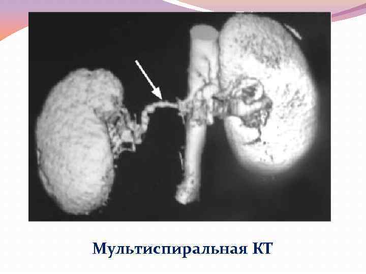 Мультиспиральная КТ 