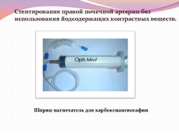 Стентирование правой почечной артерии без использования йодсодержащих контрастных веществ. Шприц-нагнетатель для карбоксиангиогафии 