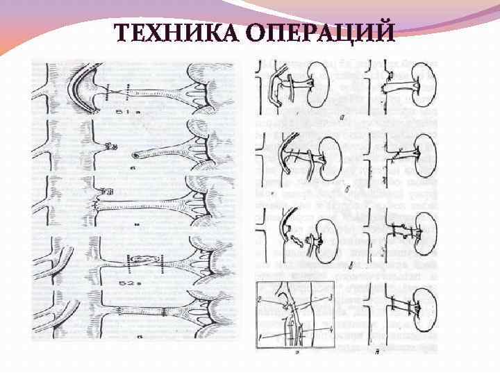 ТЕХНИКА ОПЕРАЦИЙ 