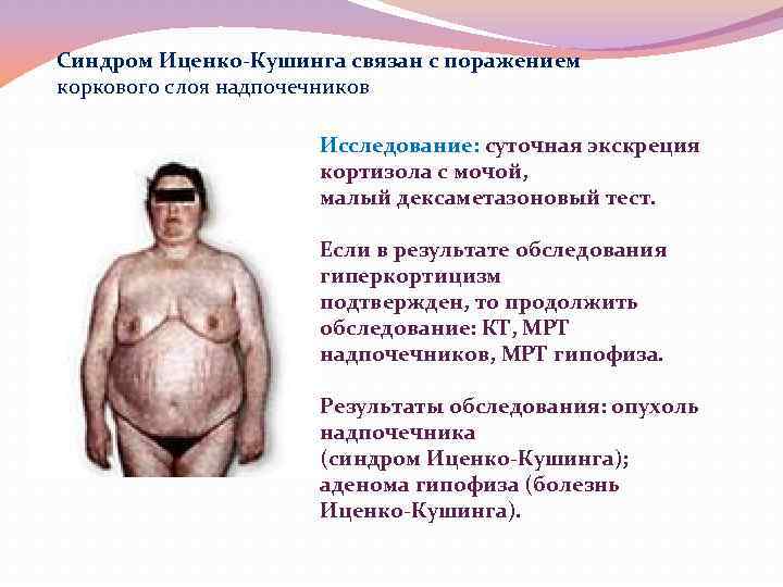 Синдром Иценко-Кушинга связан с поражением коркового слоя надпочечников Исследование: суточная экскреция кортизола с мочой,