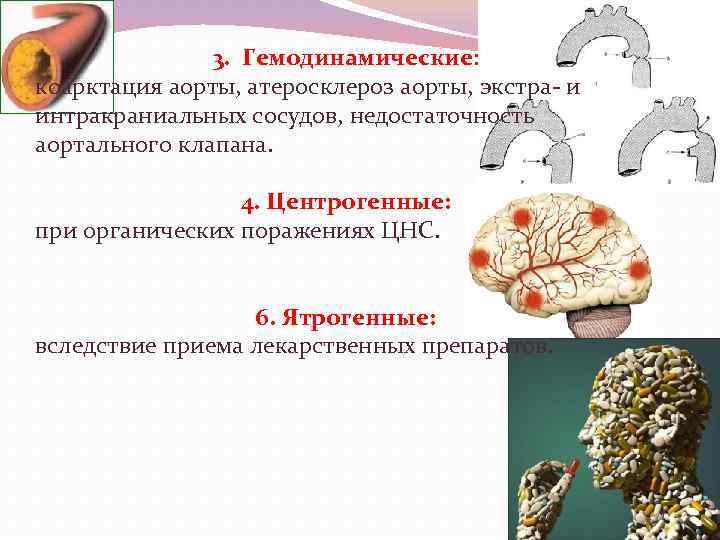 3. Гемодинамические: коарктация аорты, атеросклероз аорты, экстра- и интракраниальных сосудов, недостаточность аортального клапана. 4.