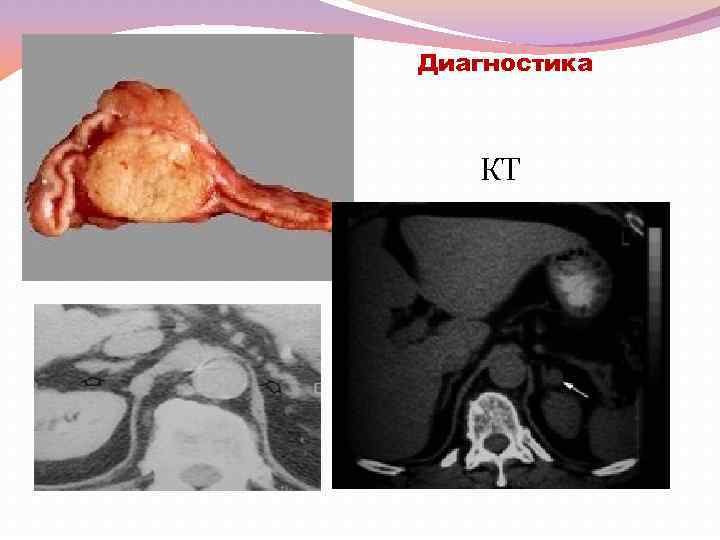 Диагностика КТ 