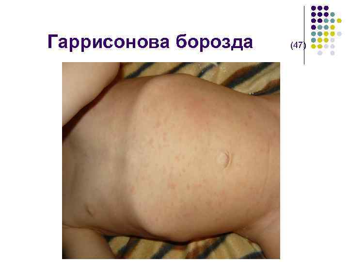  Гаррисонова борозда (47) 