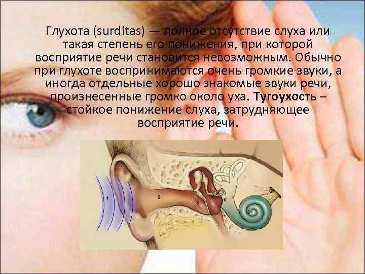 Глухота (surditas) — полное отсутствие слуха или такая степень его понижения, при которой восприятие