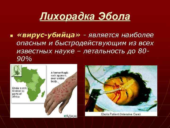 Лихорадка Эбола n «вирус-убийца» - является наиболее опасным и быстродействующим из всех известных науке
