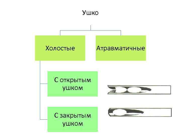 Ушко Холостые С открытым ушком С закрытым ушком Атравматичные 