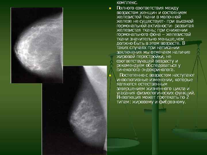 n n комплекс. Полного соответствия между возрастом женщин и состоянием железистой ткани в молочной