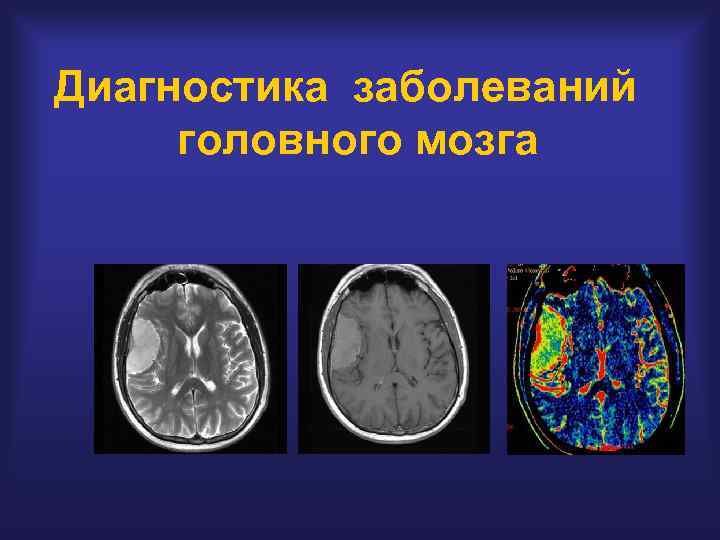 Диагностика заболеваний головного мозга 