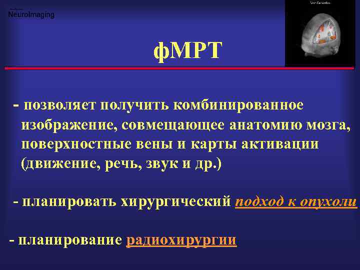 ф. МРТ - позволяет получить комбинированное изображение, совмещающее анатомию мозга, поверхностные вены и карты