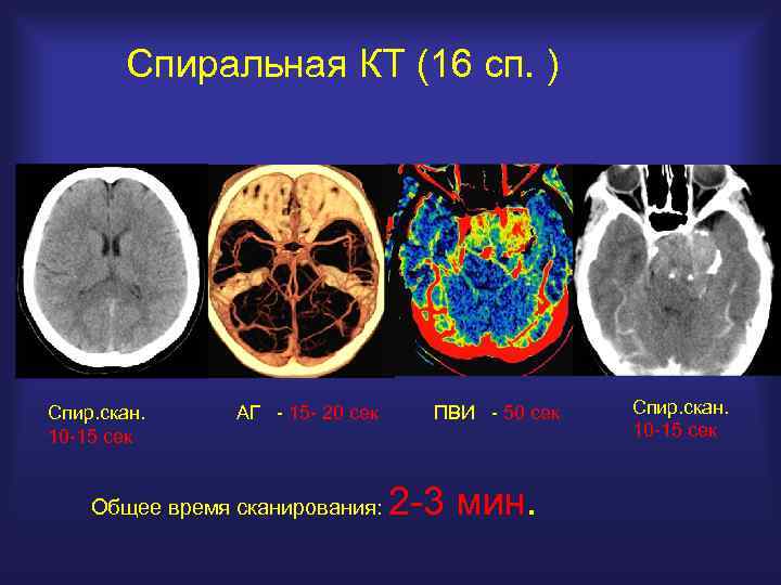 Спиральная КТ (16 сп. ) Спир. скан. 10 -15 сек АГ - 15 -