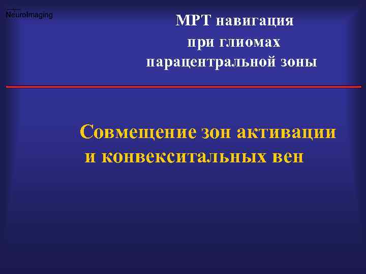 МРТ навигация при глиомах парацентральной зоны Совмещение зон активации и конвекситальных вен 