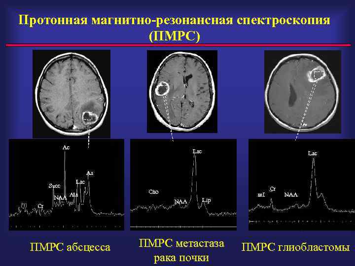 Изображение взвешенное по протонной плотности