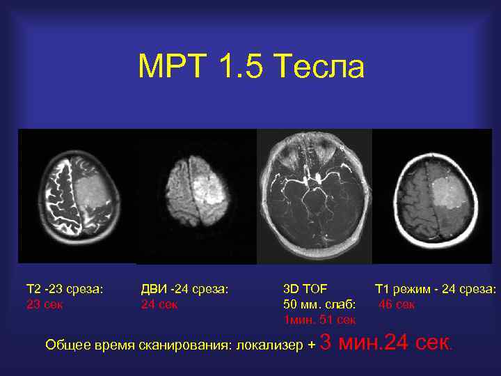 Мрт мозга 1 тесла