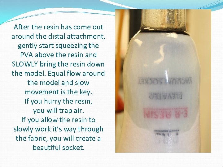 After the resin has come out around the distal attachment, gently start squeezing the