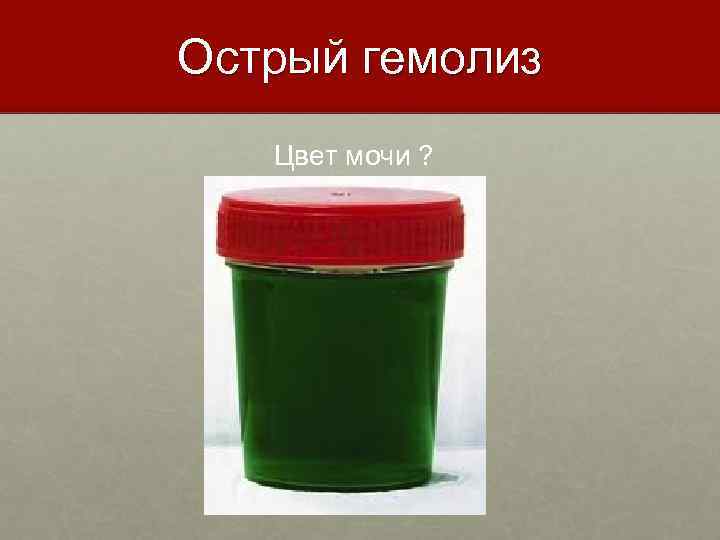 Острый гемолиз Цвет мочи ? 