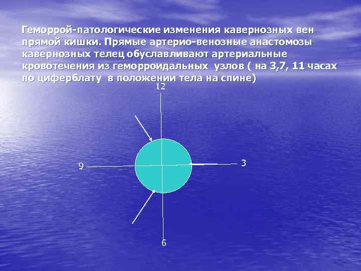 Геморрой-патологические изменения кавернозных вен прямой кишки. Прямые артерио-венозные анастомозы кавернозных телец обуславливают артериальные кровотечения
