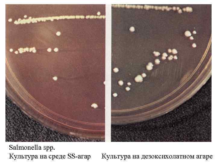 CЕМЕЙСТВО БАКТЕРИЙ ENTEROBACTERIACEAE Роды 1 Escherichia 2