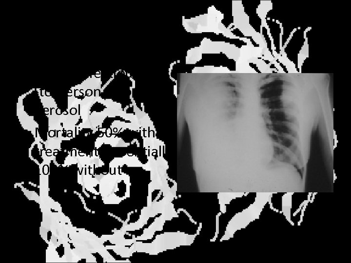 Pneumonic plague • Highly infectious person -to-person through aerosol • Mortality 50% with treatment,