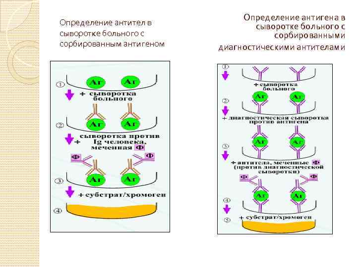 Определение антител в сыворотке больного с сорбированным антигеном Определение антигена в сыворотке больного с