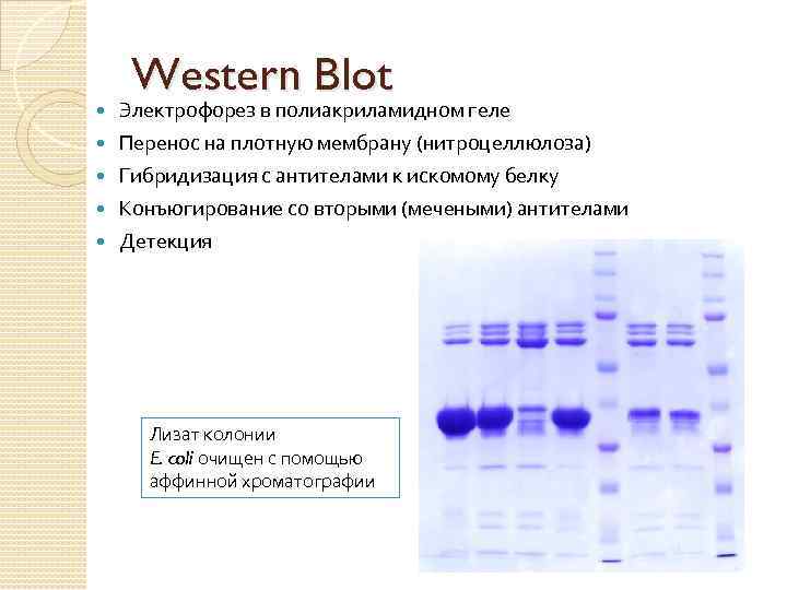  Western Blot Электрофорез в полиакриламидном геле Перенос на плотную мембрану (нитроцеллюлоза) Гибридизация с