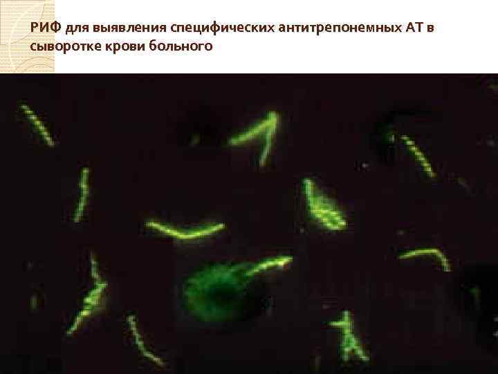 РИФ для выявления специфических антитрепонемных АТ в сыворотке крови больного 