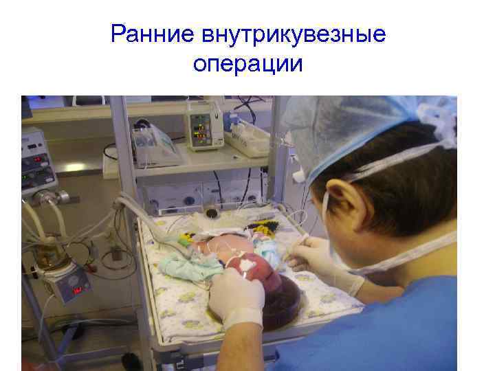 Ранние внутрикувезные операции 