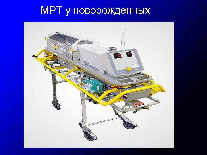 МРТ у новорожденных 