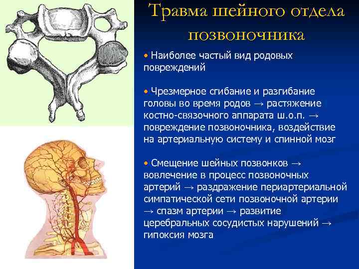 Повреждение шейного отдела позвоночника