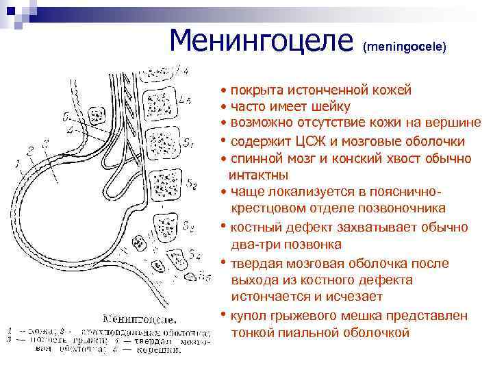 Менингоцеле (meningocele) • покрыта истонченной кожей • часто имеет шейку • возможно отсутствие кожи