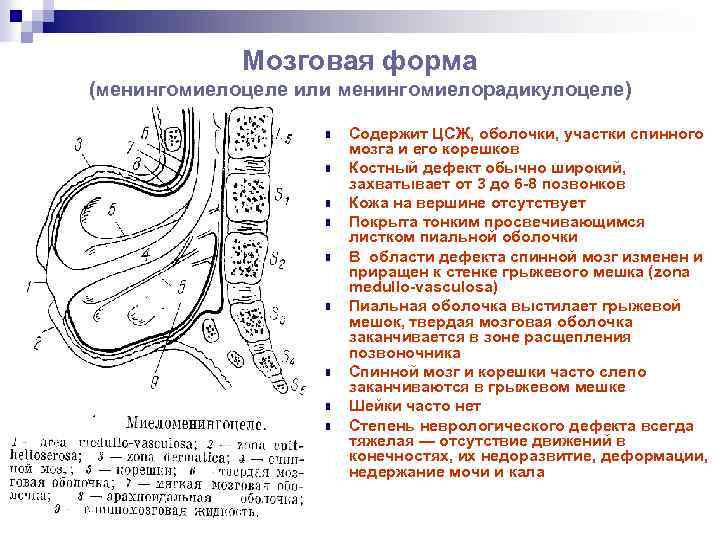 Мозговая форма (менингомиелоцеле или менингомиелорадикулоцеле) n n n n n Содержит ЦСЖ, оболочки, участки