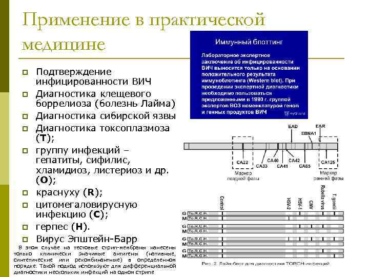 Применение в практической медицине p p p p p Подтверждение инфицированности ВИЧ Диагностика клещевого