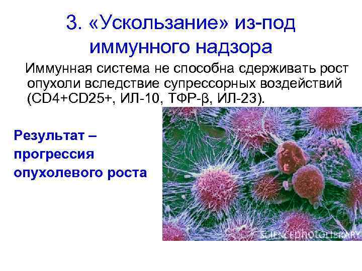 3. «Ускользание» из-под иммунного надзора Иммунная система не способна сдерживать рост опухоли вследствие супрессорных