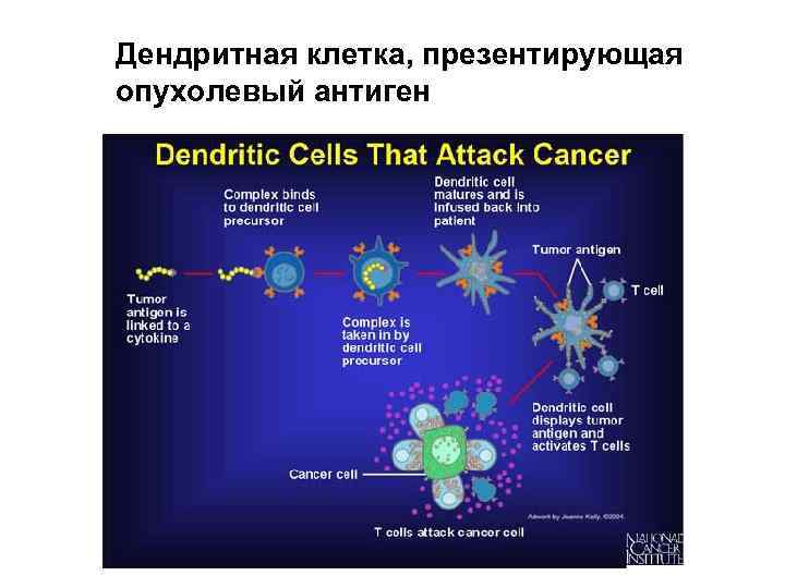 Дендритная клетка, презентирующая опухолевый антиген 