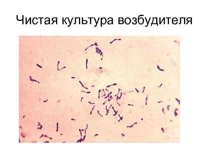 Чистая культура возбудителя 