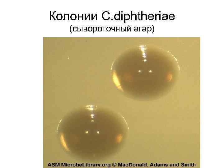 Колонии C. diphtheriae (сывороточный агар) 