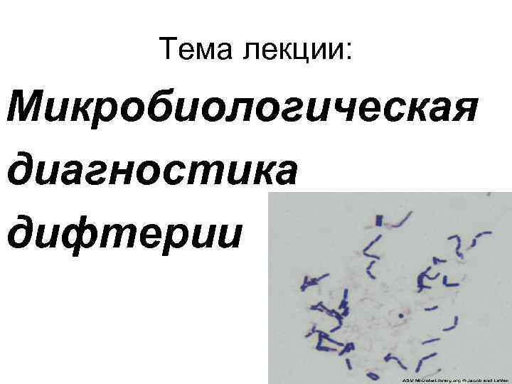 Тема лекции: Микробиологическая диагностика дифтерии 
