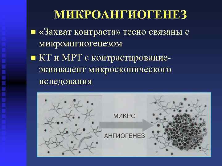 МИКРОАНГИОГЕНЕЗ «Захват контраста» тесно связаны с микроангиогенезом n КТ и МРТ с контрастирование- эквивалент