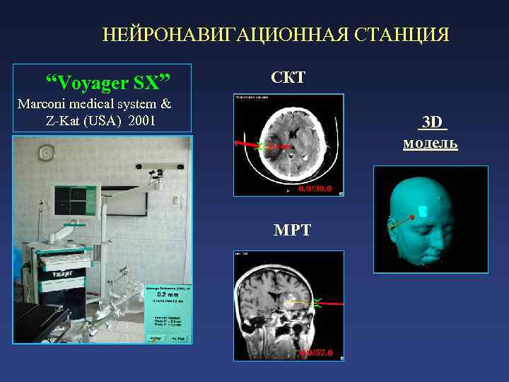  НЕЙРОНАВИГАЦИОННАЯ СТАНЦИЯ “Voyager SX” СКТ Marconi medical system & Z-Kat (USA) 2001 3