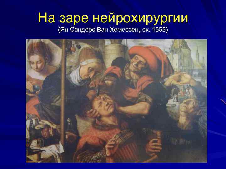 На заре нейрохирургии (Ян Сандерс Ван Хемессен, ок. 1555) 
