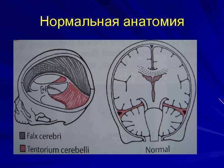 Нормальная анатомия 