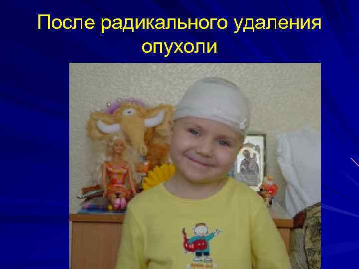 После радикального удаления опухоли 