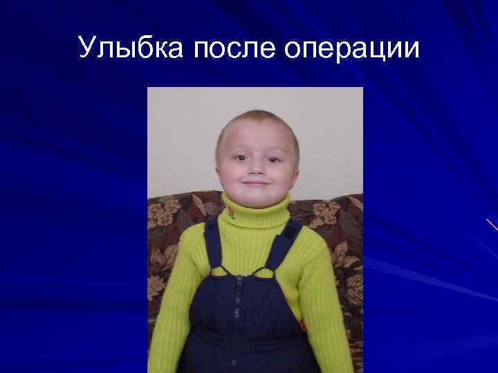 Улыбка после операции 