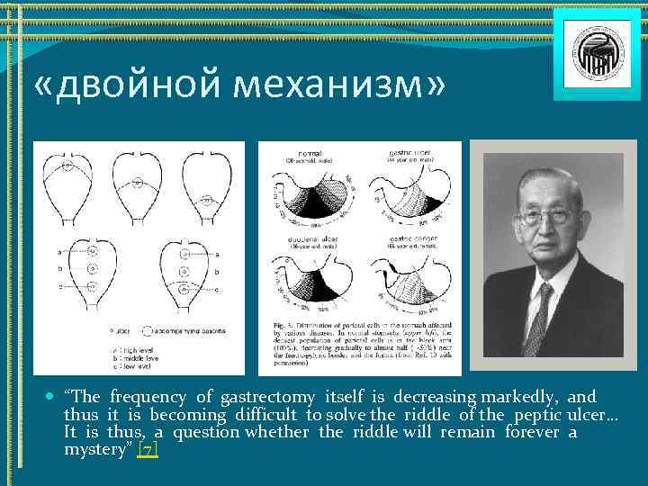  «двойной механизм» “The frequency of gastrectomy itself is decreasing markedly, and thus it