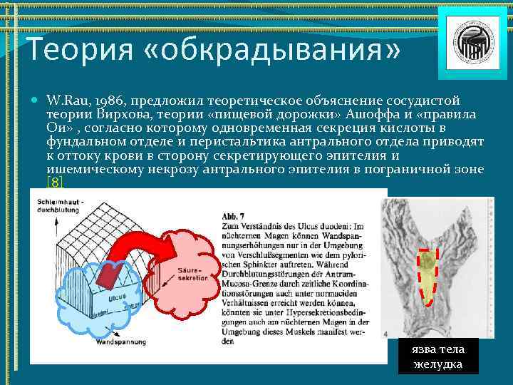 Ульцерогенез. Синдром межкоронарного обкрадывания. Теория раздражения р. Вирхова. Теория Ашоффа язвенной болезни. Теория Вирхова онкология.