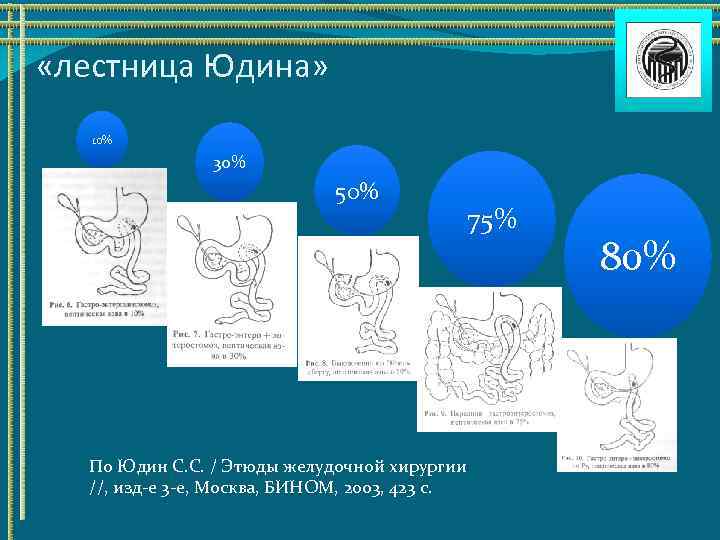  «лестница Юдина» 10% 30% 50% 75% По Юдин С. С. / Этюды желудочной