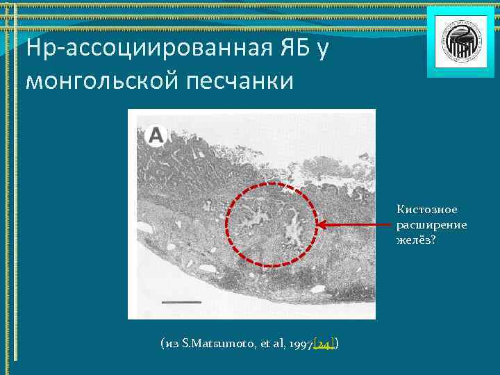 Нр-ассоциированная ЯБ у монгольской песчанки Кистозное расширение желёз? (из S. Matsumoto, et al, 1997[24])